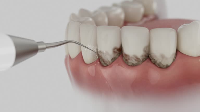 Reliable Dental contractor in Miles, TX by Smile Center Dentistry